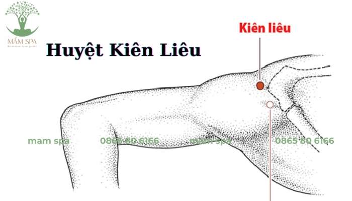 Huyệt Kiên Liêu nằm ở chỗ lõm phía dưới và sau mỏm cùng vai